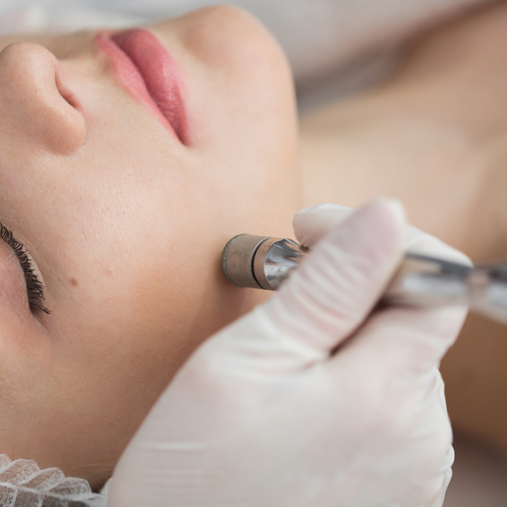 Limpieza Facial con Microdermoabrasión